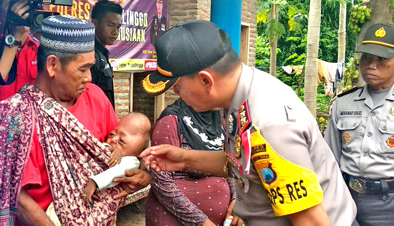 Kapolres Kunjungi Balita Idap Microcephali