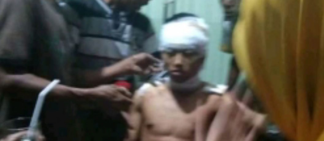 Santri Ponpes Al-Fatih Dibegal, Korban Alami Luka Bacok di Punggung dan Kepala