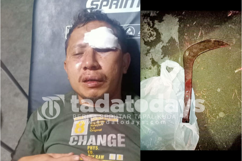 Lerai Tetangga Berkelahi, Anggota TNI di Probolinggo Kena Bacok