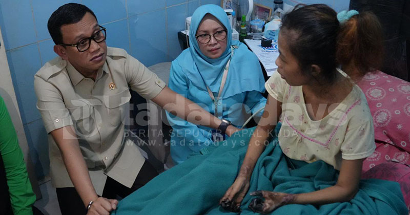 Kisah Pilu Septi Kurnia Rini, PMI Pulang dari Singapura, Tangan dan Kaki Menghitam