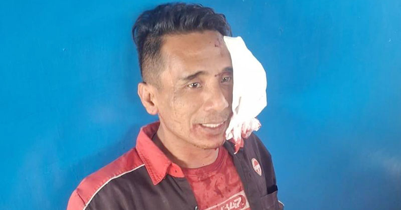 Sopir Bus di Pasuruan Jadi Korban Pembacokan, Polisi Buru Pelaku